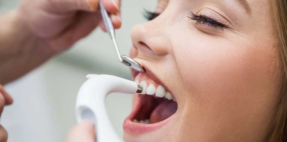 Air Flow — это система отбеливания зубов и профессиональной чистки зубов