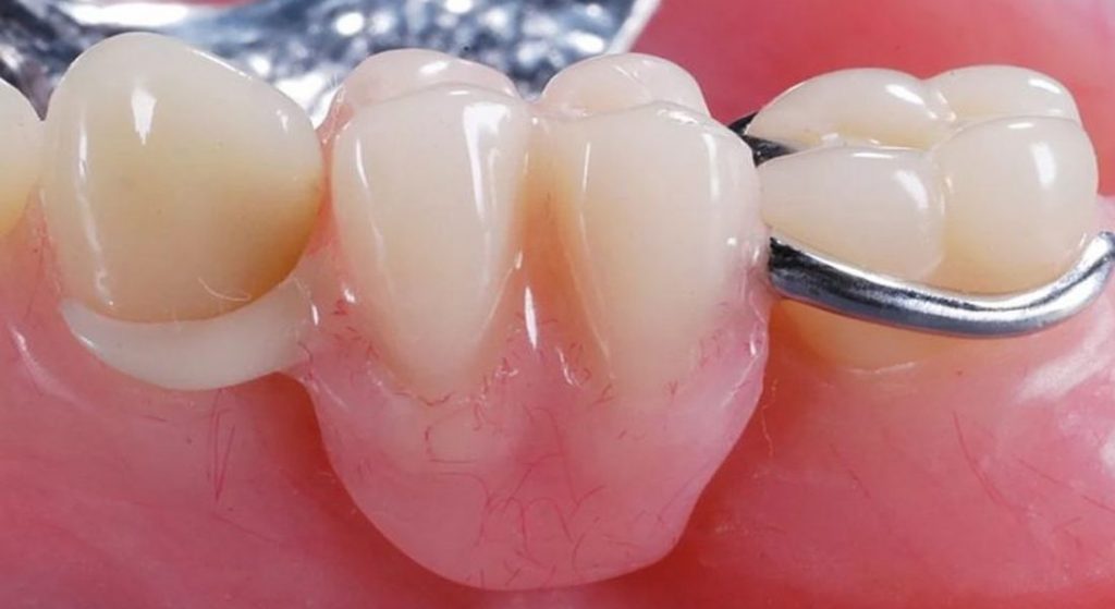 Результат за один прием